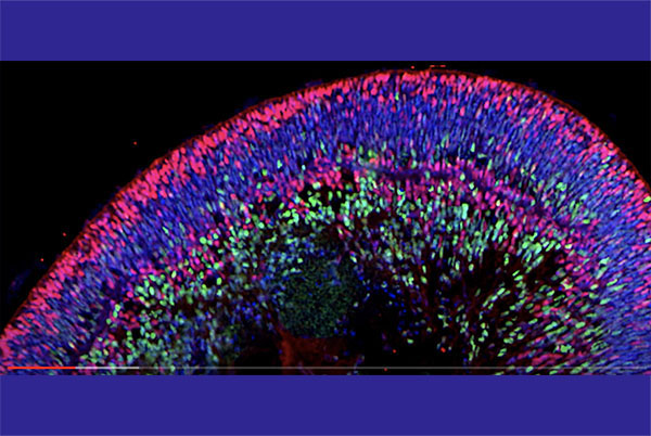 retina organoid